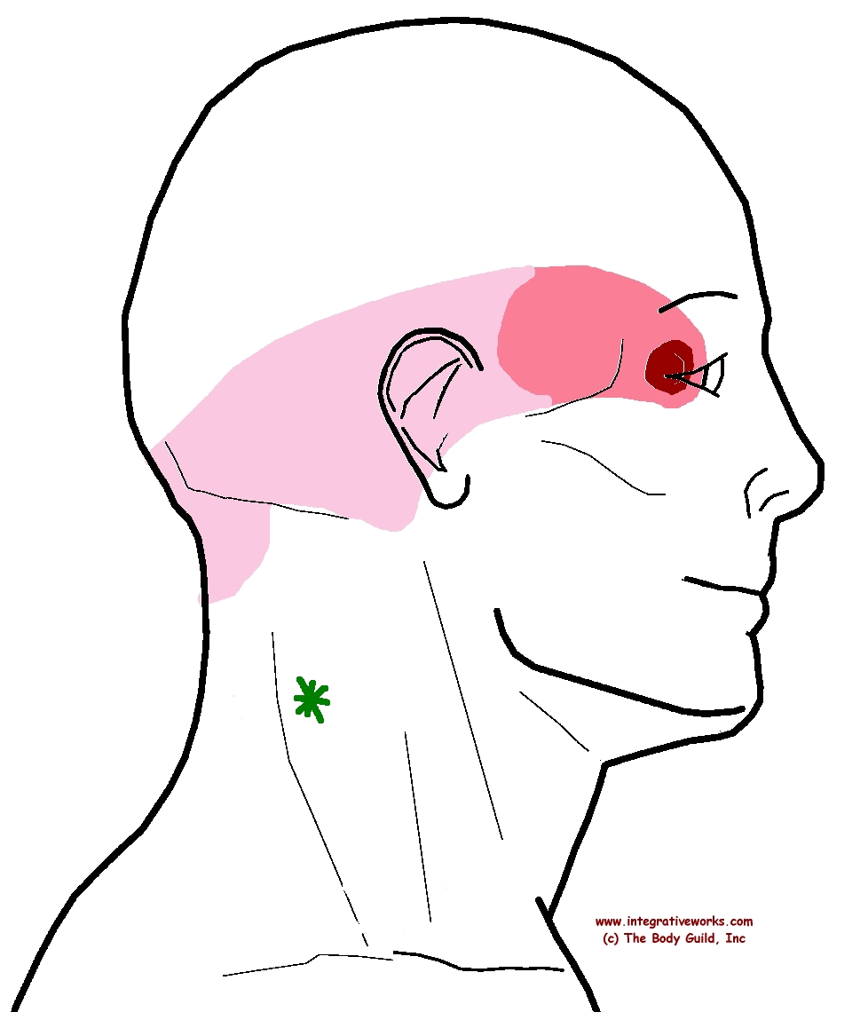 dolor de cabeza  ojo izquierdo