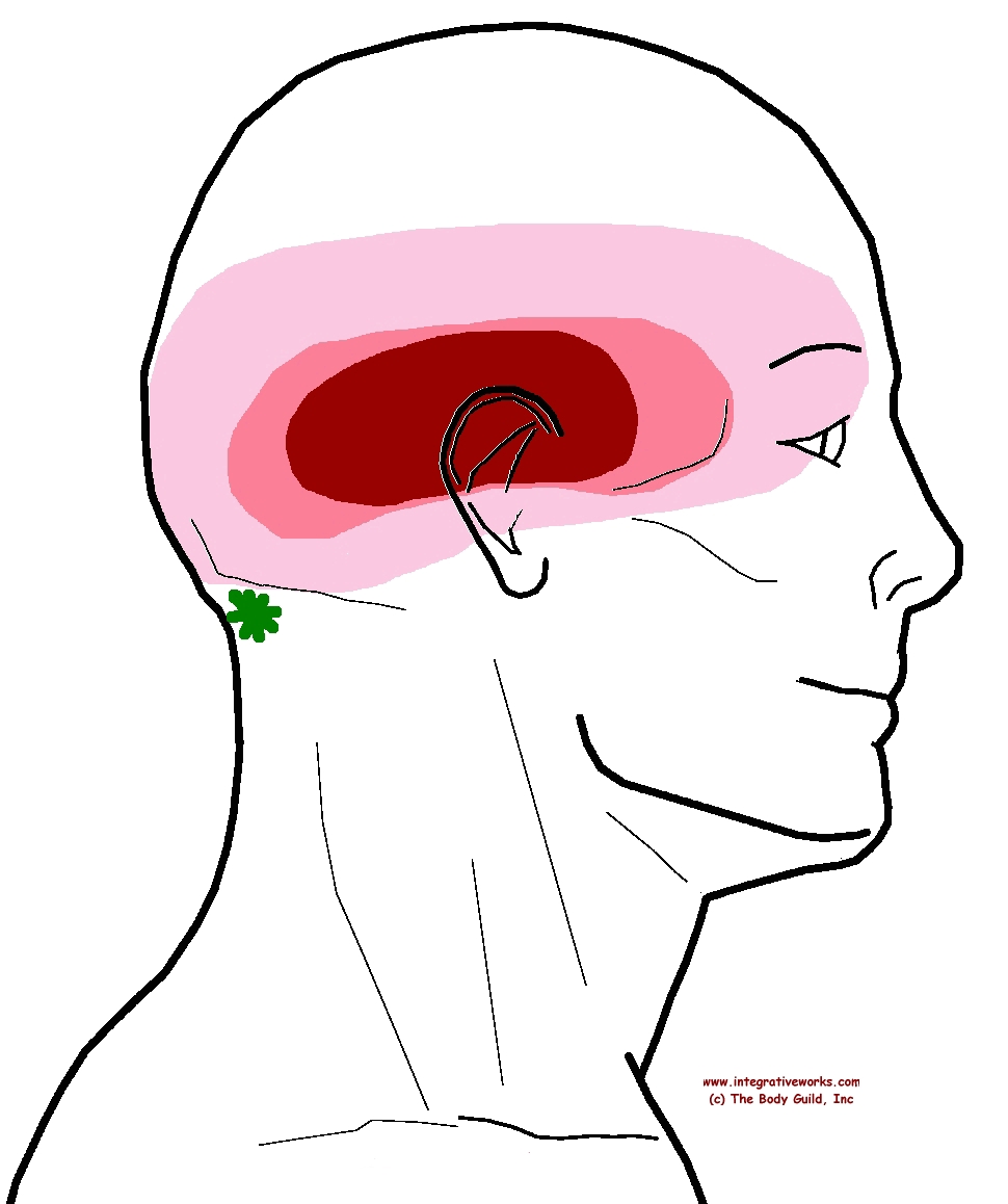 Migraine All Over Or Band On One Side Integrative Works