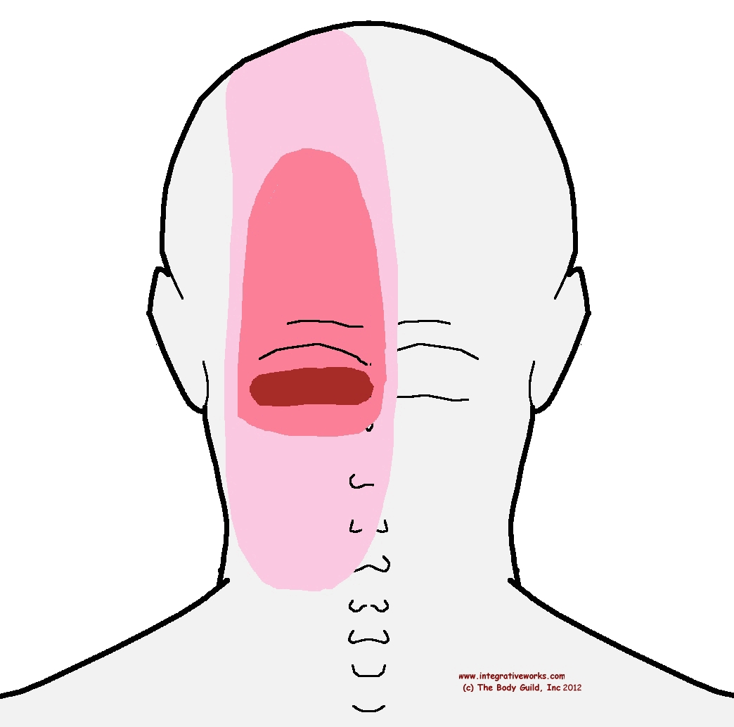 Migraine Headache Migraine Headache On Left Side Of Head