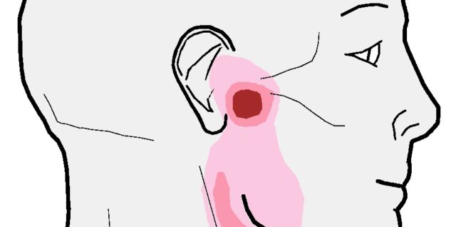 Sinus infection treatment exercise
