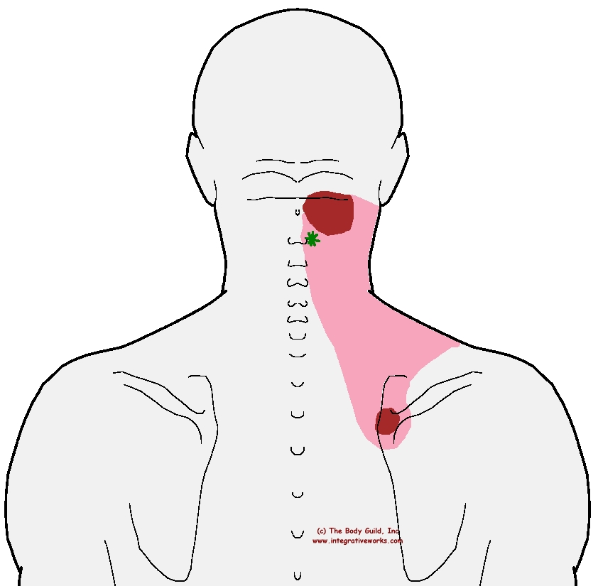 lymph nodes sore in back of neck