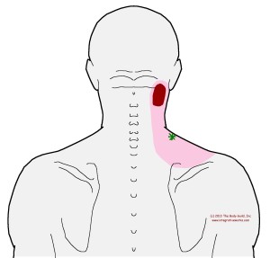 Neck Tension When Wearing A Heavy Coat 