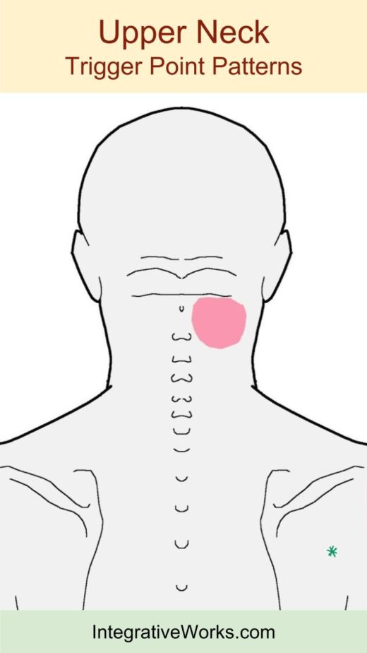 Neck - Trigger Point Pain and Impaired Function - Integrative Works