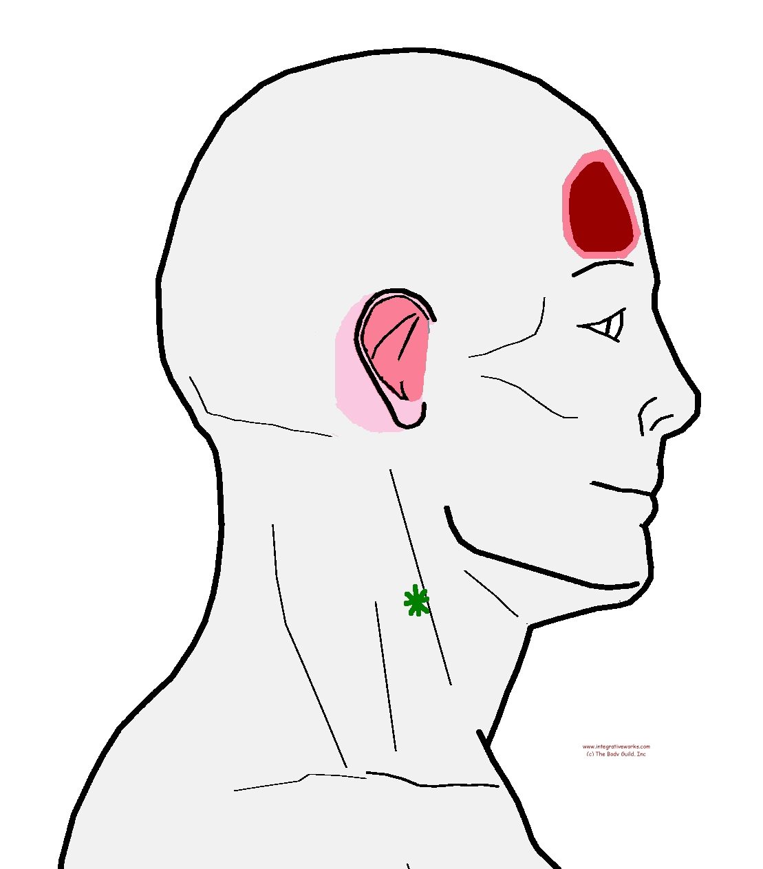 Headache in the Forehead - Integrative Works