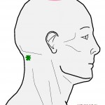 Headache around the eyebrow. | Integrative Works