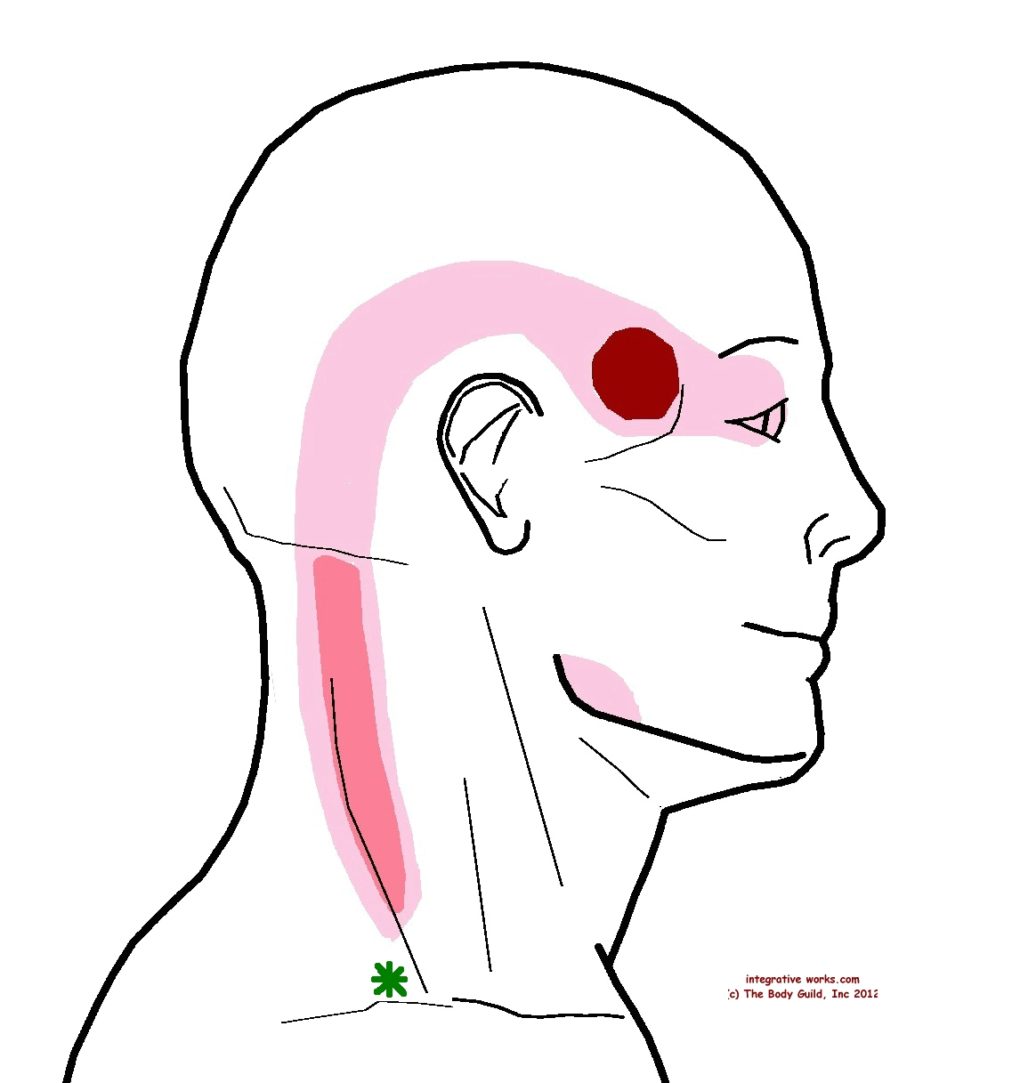 Headache At Your Temple with Stiff Neck - Integrative Works