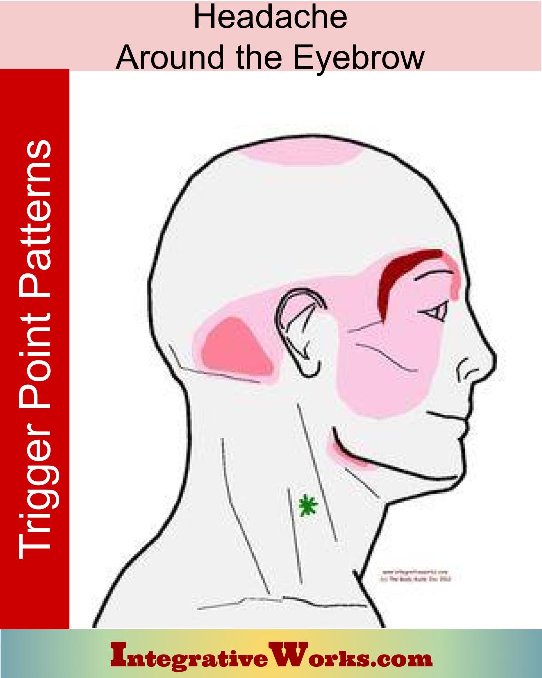 pinpoint headache above right ear