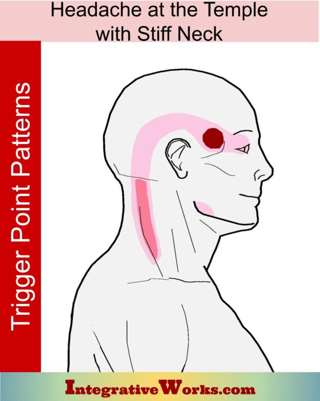 Headache At Your Temple with Stiff Neck - Integrative Works