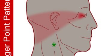 Neck-ache Headache, Eye-ache