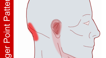 Pain In The Base Of The Head With Earache