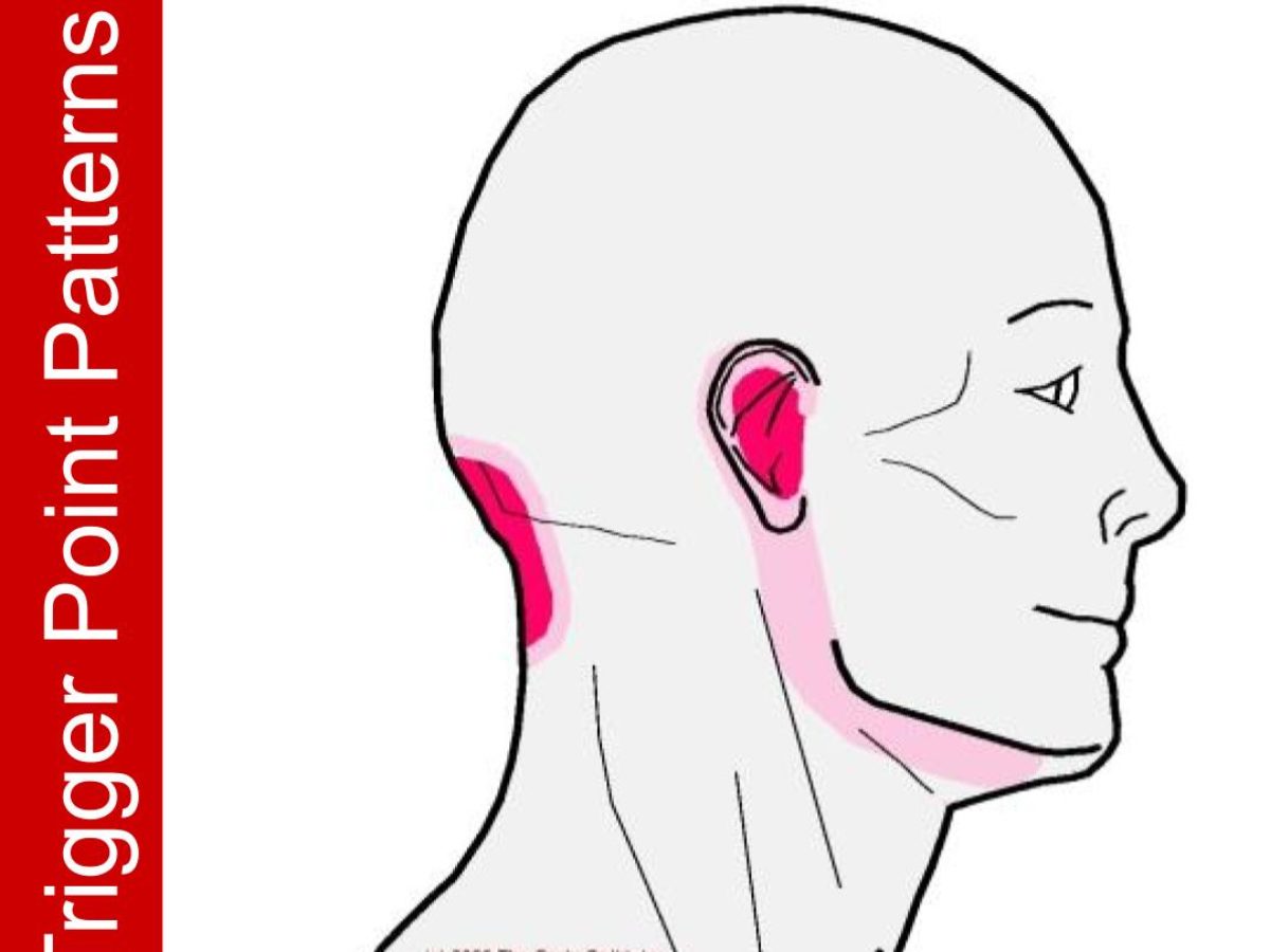 Pain In The Base Of The Head With Earache Integrative Works