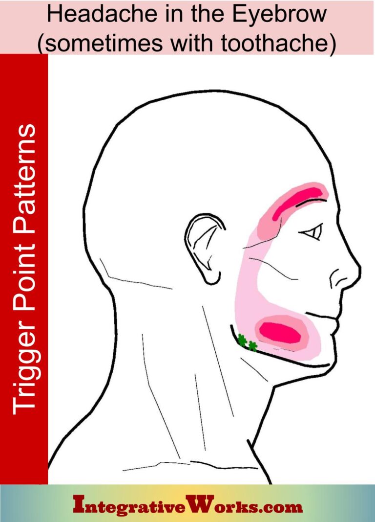 Headache On Eyebrow Bone