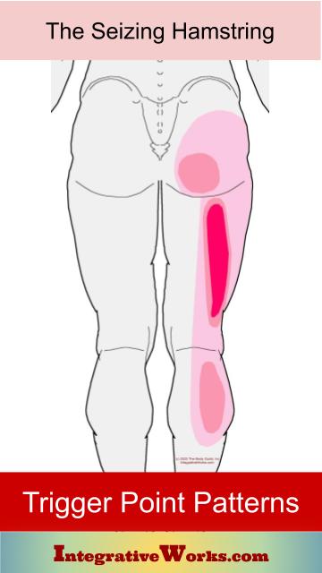 Trigger Points and The Seizing Hamstring - Integrative Works