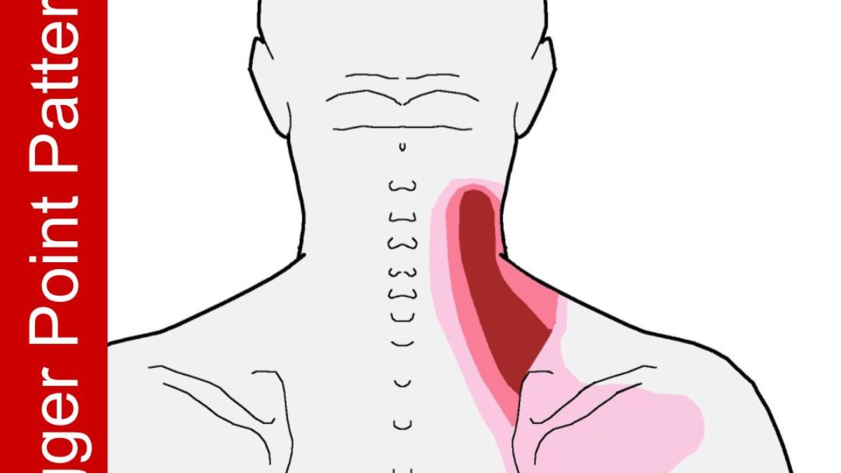 Pain in neck when 2025 turning head side to side