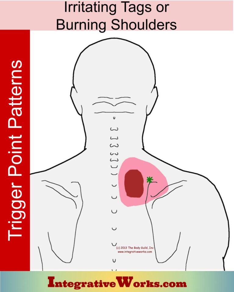 Irritating Tags, Burning Shoulders - Integrative Works