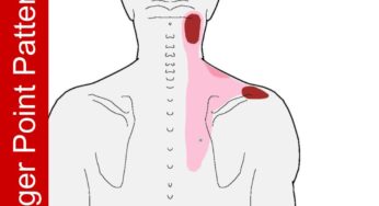 Upper Neck Pain with Sore Top of Shoulder