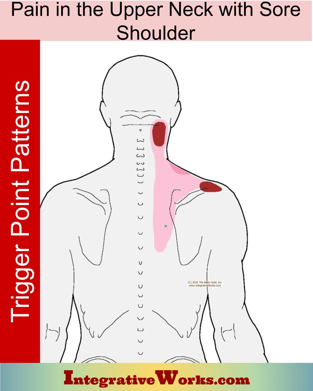 Upper Neck Pain with Sore Top of Shoulder