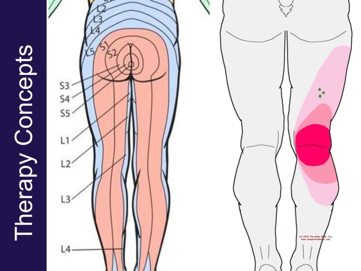 sciatic nerve dermatome