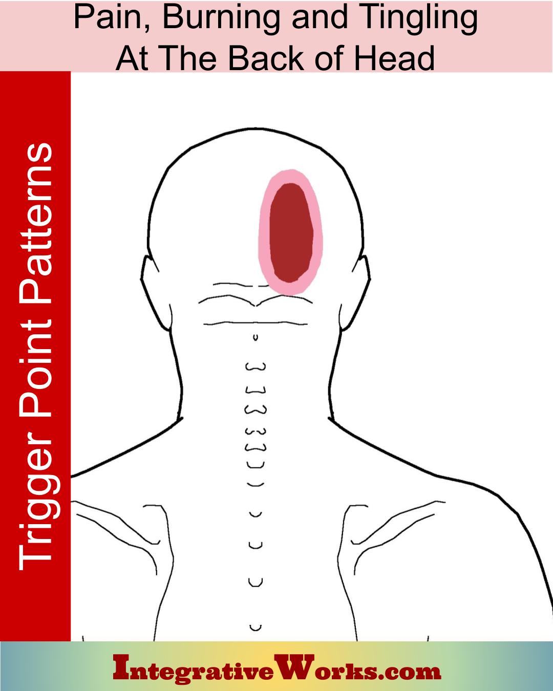 コンプリート！ back head pain 137925Back head pain symptoms Saesipapictur2