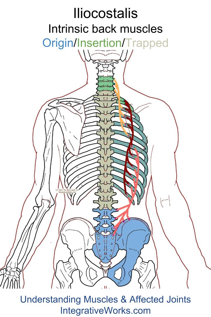 Mid-back pain that extends up and around - Integrative Works