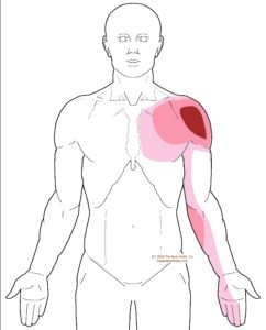 Front of shoulder pain when raising arm | Integrative Works