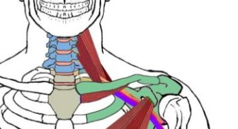 Do You Find Trigger Point Illustrations Confusing?