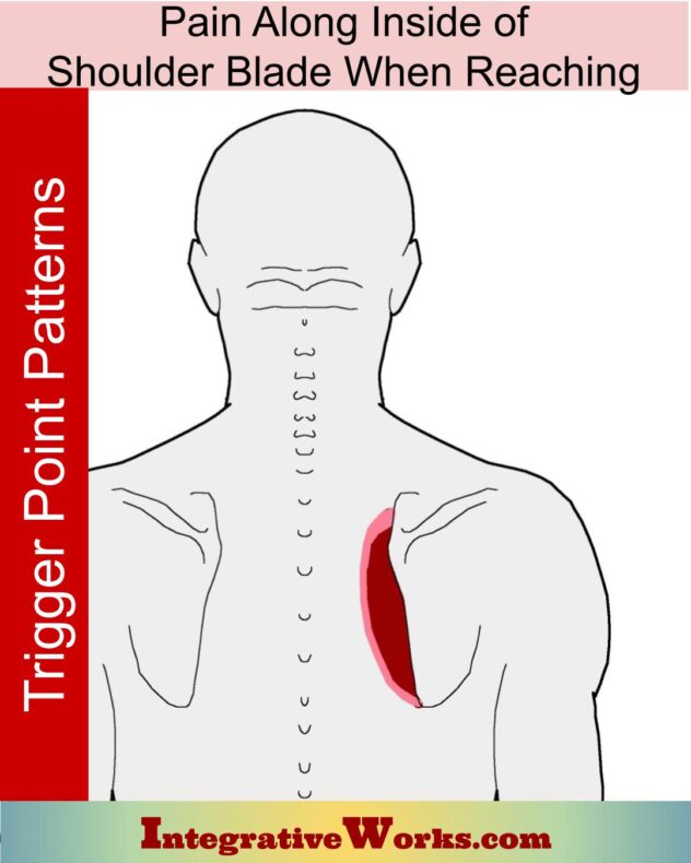 Pain Between Shoulder Blades Pain Patterns Causes Self Care   Trigger Points Pain Along The Inside Of Shoulder Blade When Reaching 632x790 