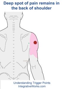 fi-deep-spot-of-pain-remains-in-back-of-shoulder