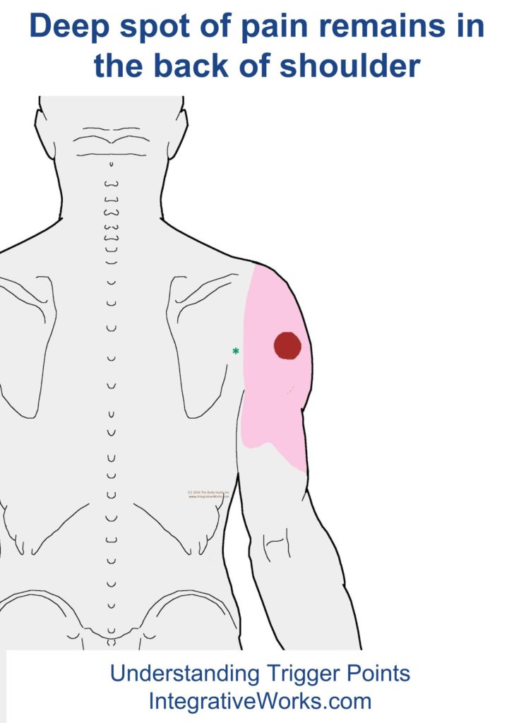 rotator cuff Integrative Works