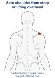 fi-sore-shoulder-from-strap-of-lifting-overhead