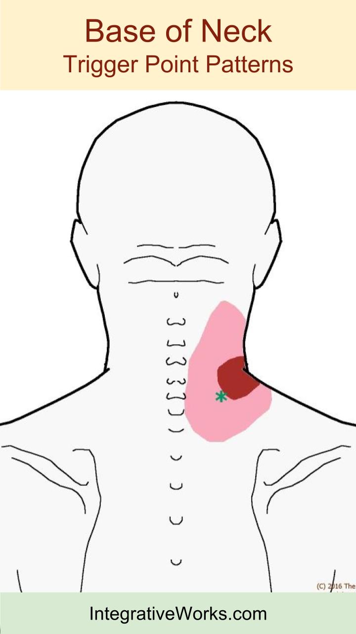 tags-base-of-neck