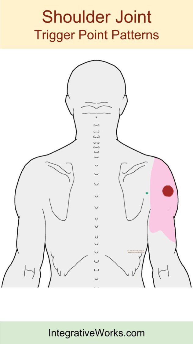 Shoulder - Pain and Impaired Function - Integrative Works