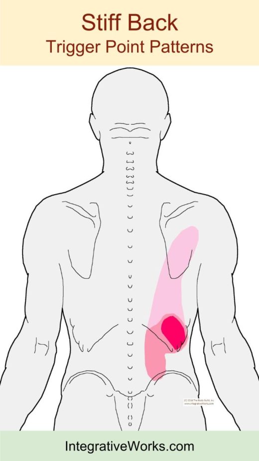 Mid-back pain that extends up and around - Integrative Works