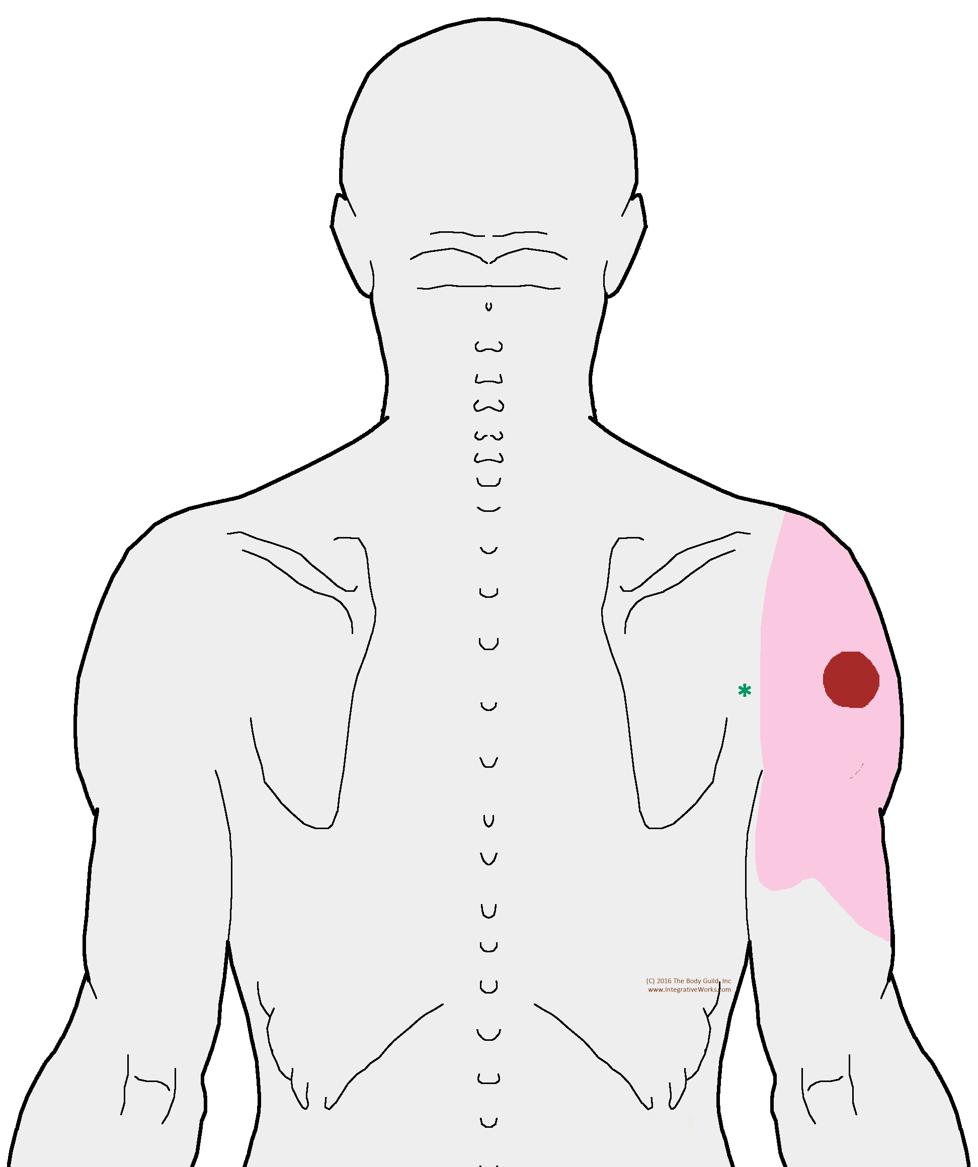 Spot of pain behind shoulder - Integrative Works