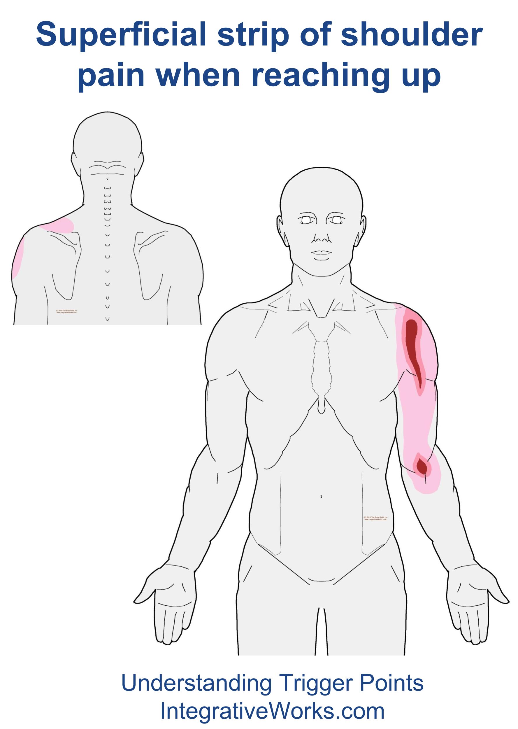 Pain In Front Of Shoulder Reaching Forward