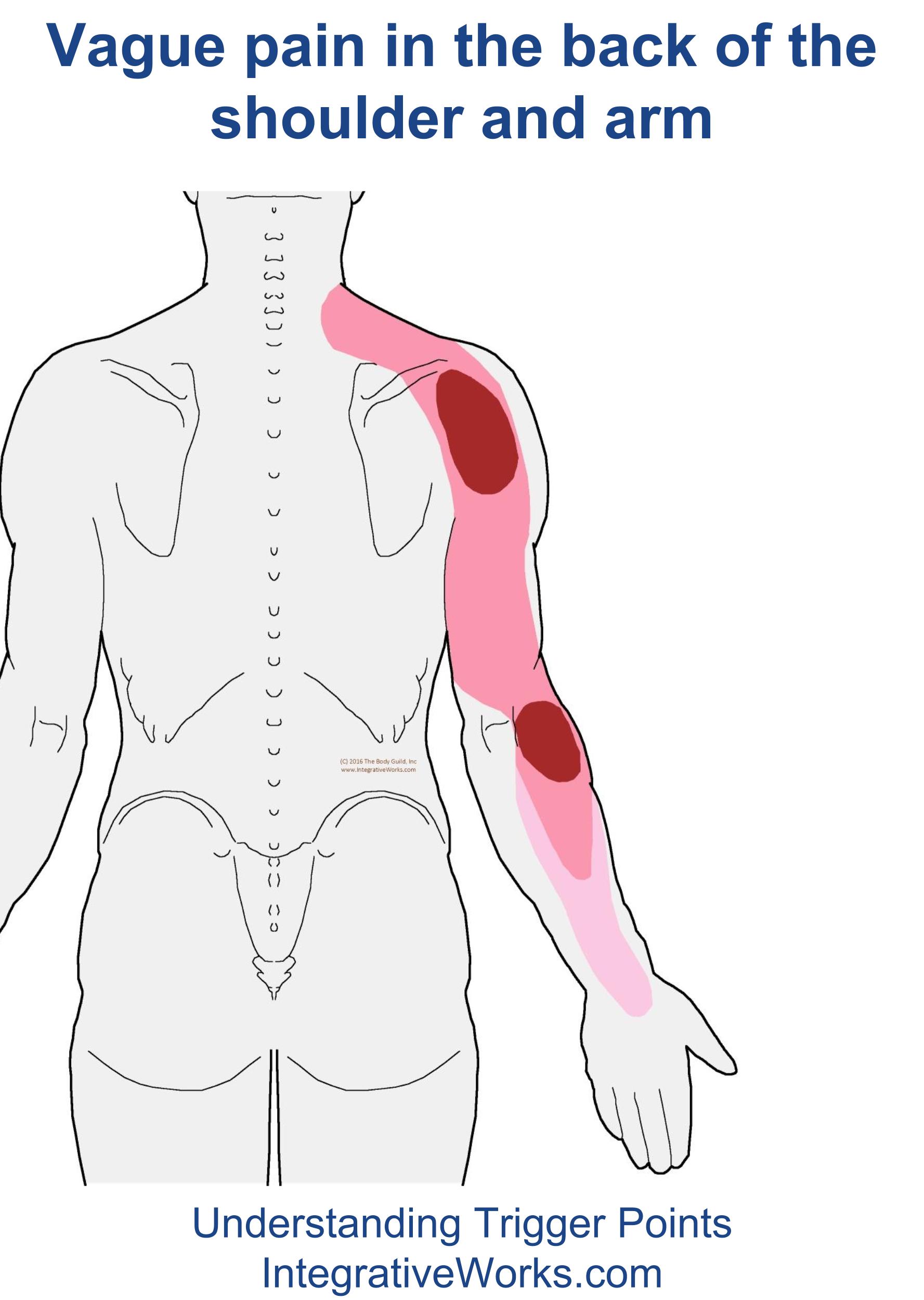 Vague pain in the back of the shoulder and arm - Integrative Works