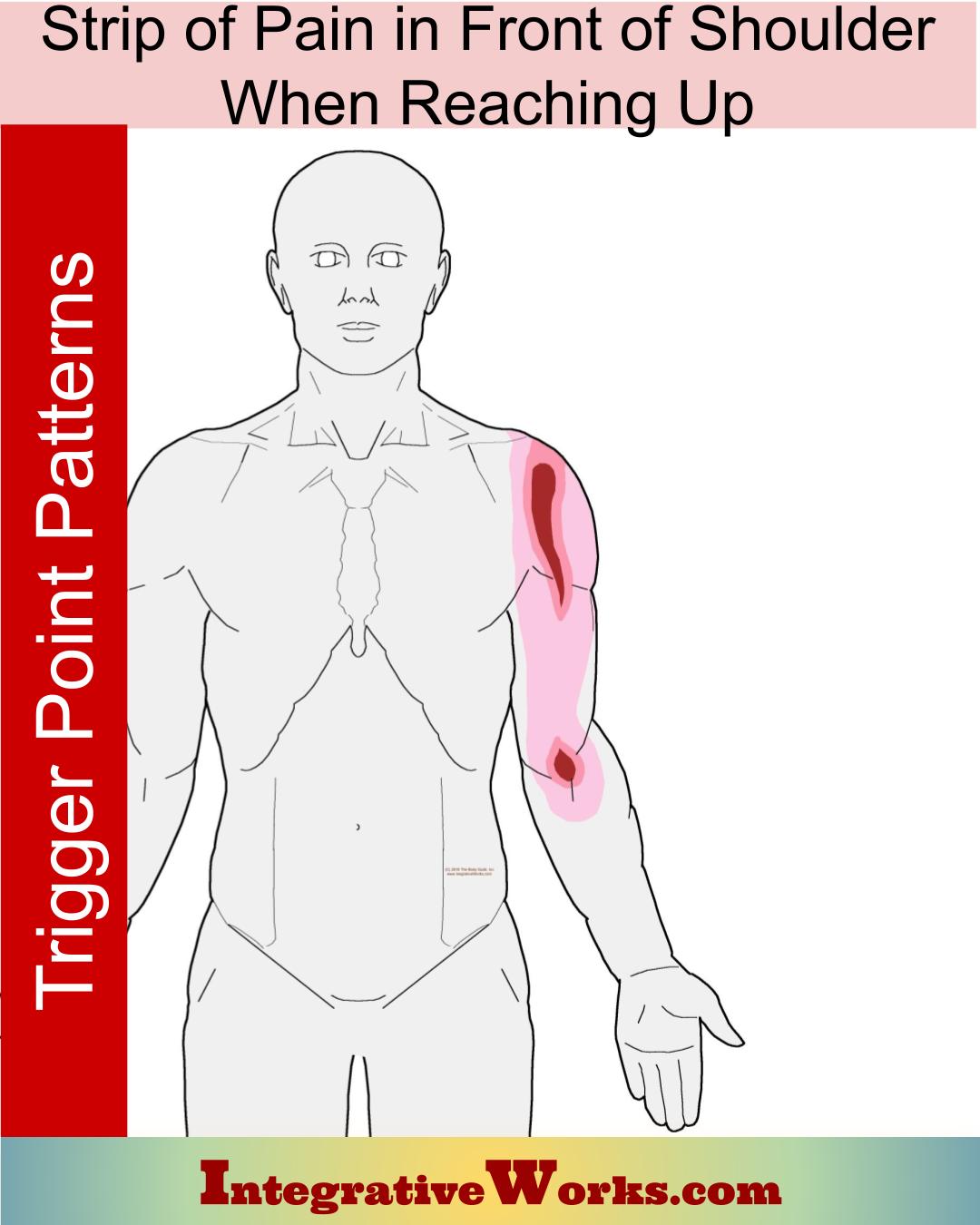 Superficial strip of shoulder pain when reaching up