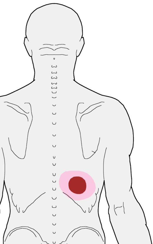 Aching and Burning in the mid back - Integrative Works