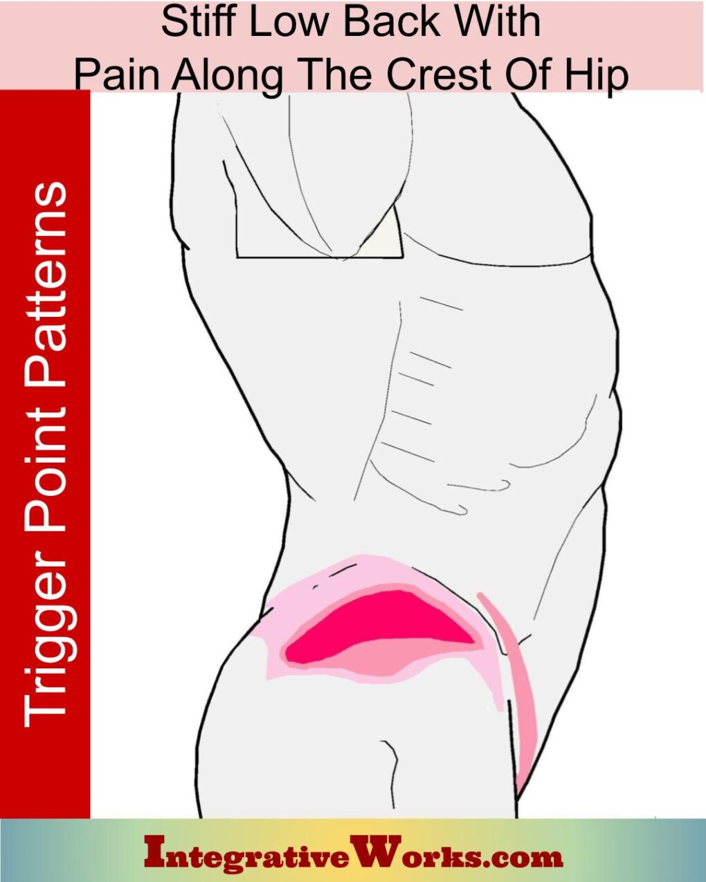 Pain Around the Crest of the Hip - Integrative Works