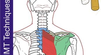 Rhomboids & Serratus Posterior Superior – Neuromuscular Massage Protocol