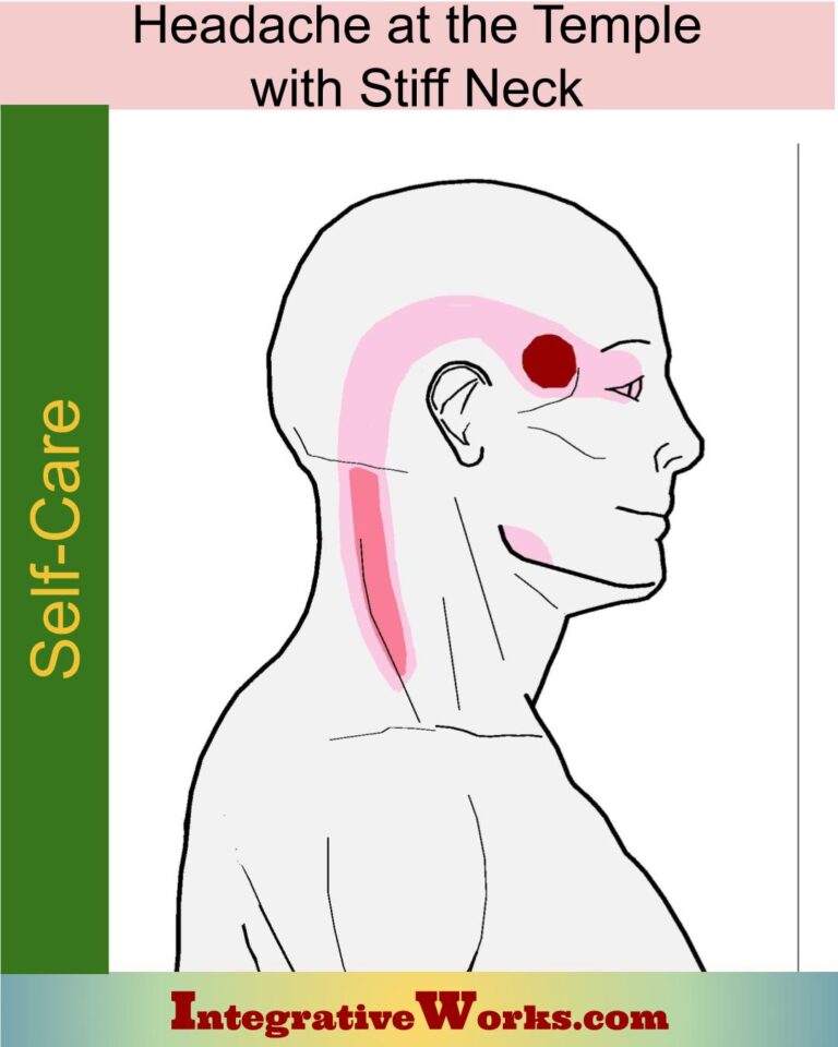 Headache At Your Temple with Stiff Neck - Integrative Works