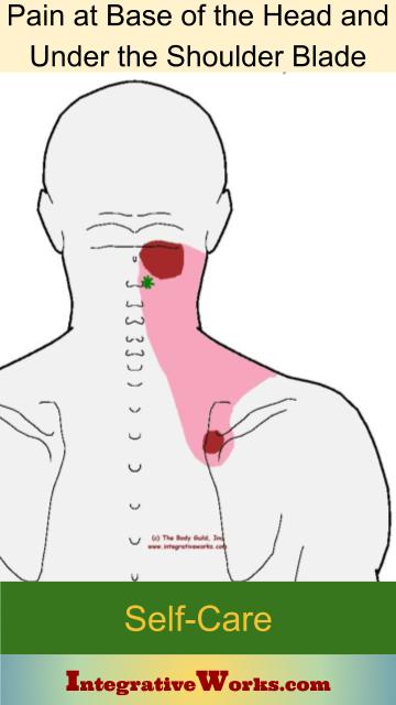 Pain at the Base of the Head and Under Shoulder Blade - Integrative Works