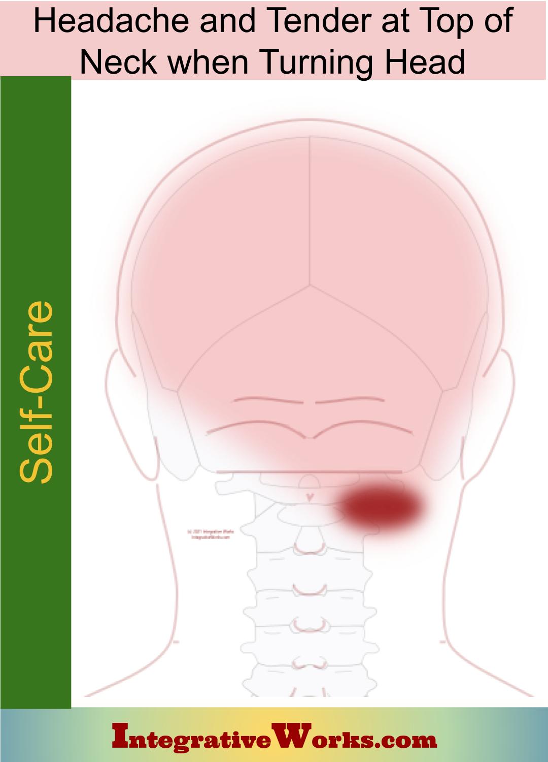 Self Care – Headache and Tender at Top of Neck when Turning Head