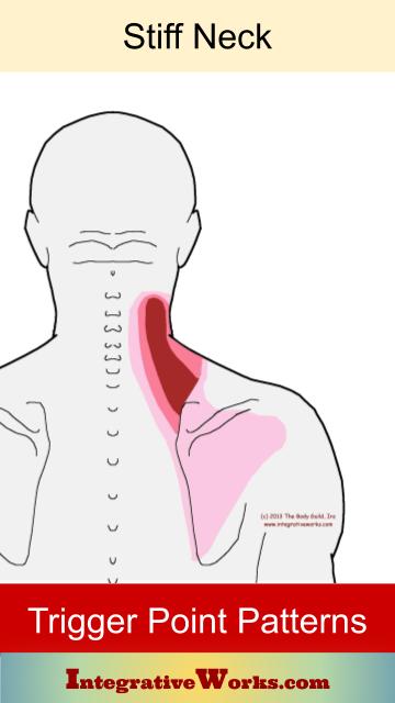 Stiffness on side of neck when turning | Integrative Works