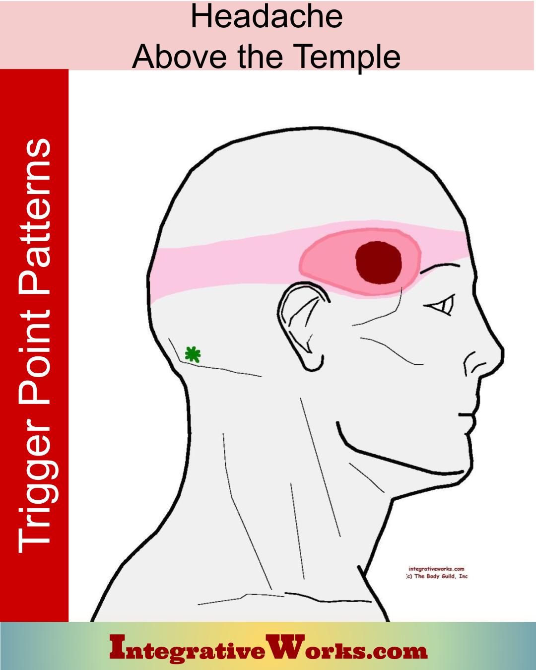 headache-chart-location-and-symptoms-for-headaches-types