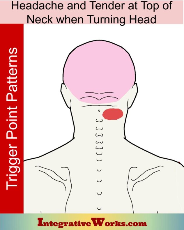 cervicogenic-headache-pain-patterns-causes-and-self-care