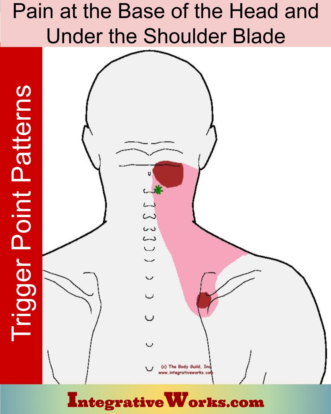 Trigger Points Pain In Base Of Head And Under Shoulder Blade 1 