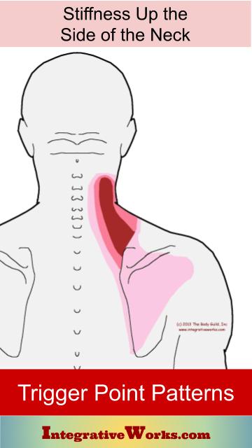 Stiffness on side of neck when turning | Integrative Works