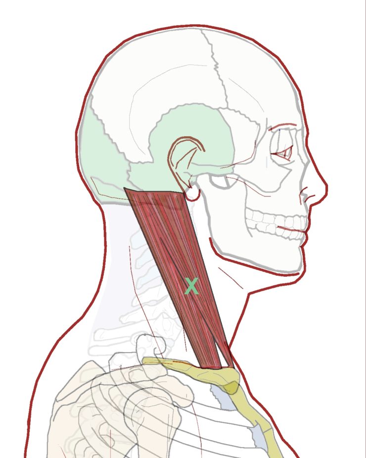 Self Care - Headache Around Brow or Forehead - Integrative Works