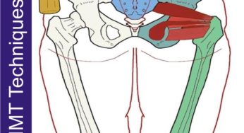 Piriformis & Deep Hip Rotators – Neuromuscular Massage Protocol